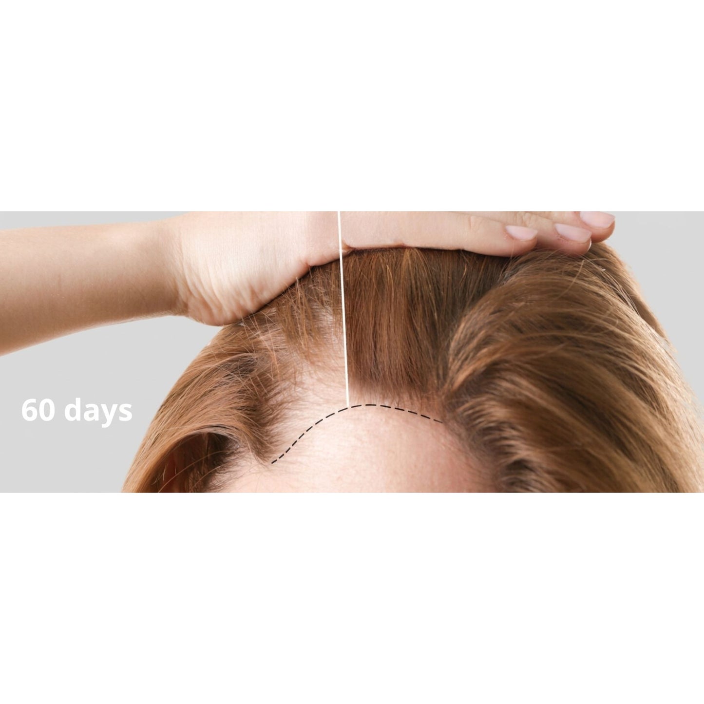 Infrared & Microcurrent Hair Growth Comb