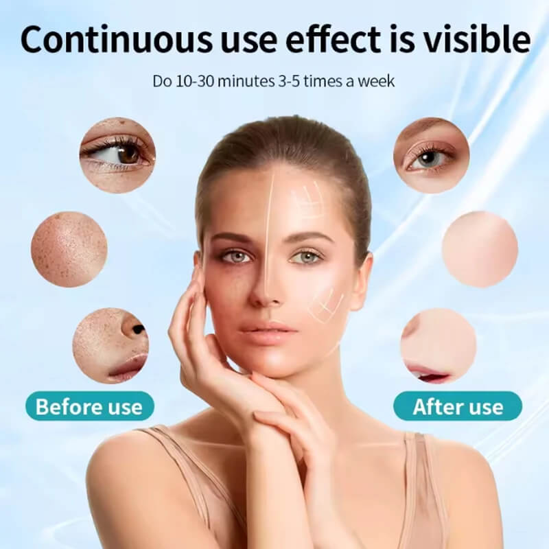LED Face & Neck Mask – Advanced Photon Light Therapy