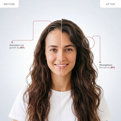 Infrared & Microcurrent Hair Growth Comb