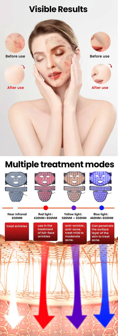 LED Face & Neck Mask – Advanced Photon Light Therapy
