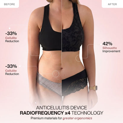 Radio Frequency Anti-Cellulite Device with X4