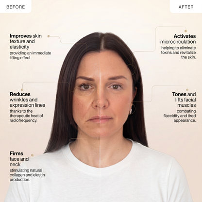 24K Gold RF Lifting Facial & Neck