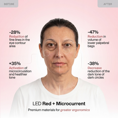 Under-Eye Bag & Dark Circle Repair Device with LED and Microcurrent