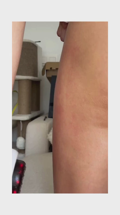 Electric Cupping Massager with Heat for Cellulite & Muscle Relief